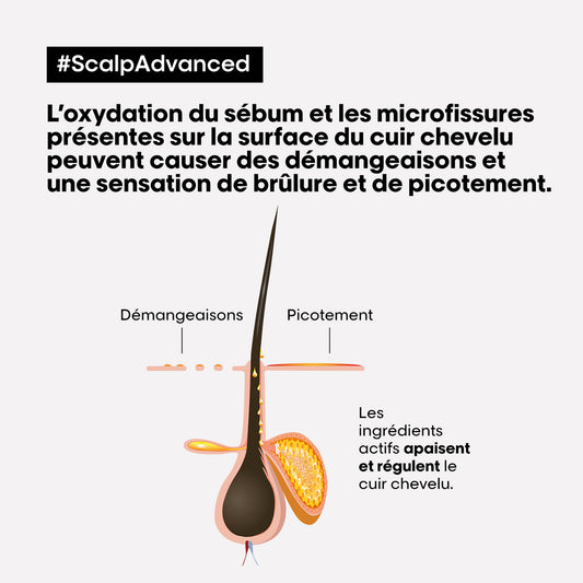 Traitement apaisant intense anti inconfort Scalp Advanced